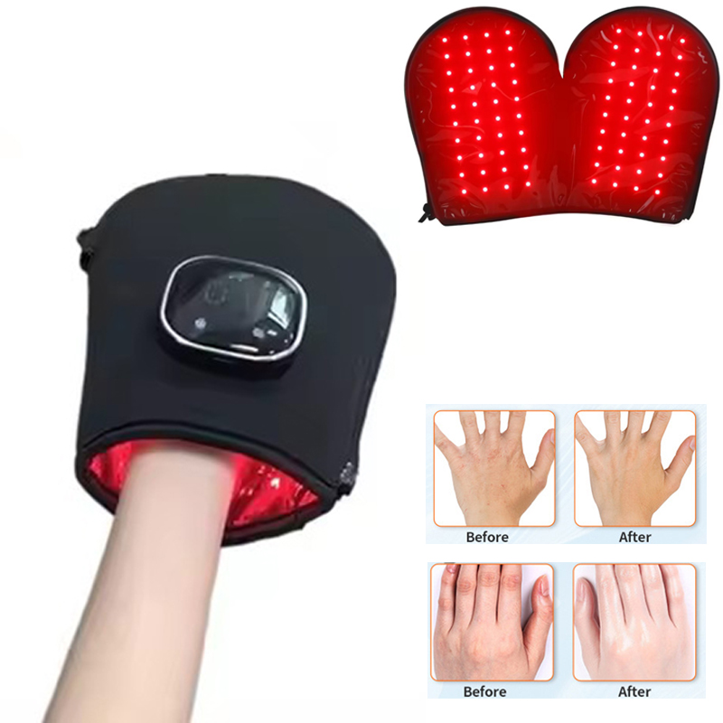 Heated Gloves Electric - NOVO Dispositivo de Terapia com Luz